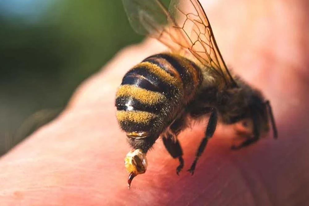 تفسير لسعة النحل في المنام
